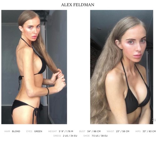 Feldman model alex 